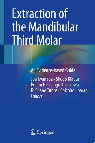 Extraction of the Mandibular Third Molar