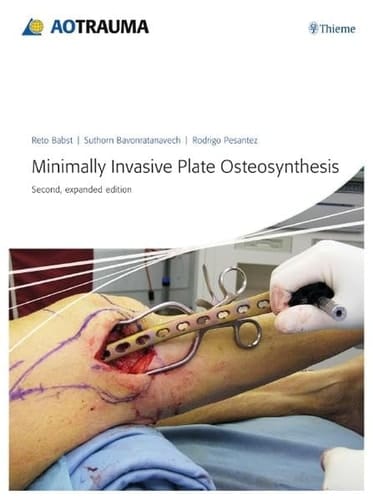 Minimally Invasive Plate Osteosynthesis