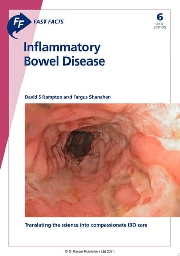 Fast Facts: Inflammatory Bowel Disease Translating the Science into Compassionate IBD Care