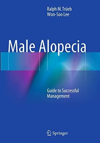 Male Alopecia Guide to Successful Management
