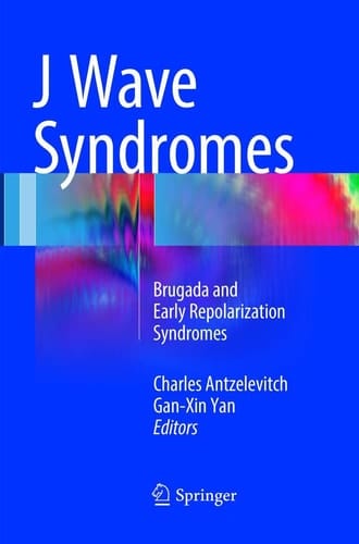 J Wave Syndromes Brugada and Early Repolarization Syndromes
