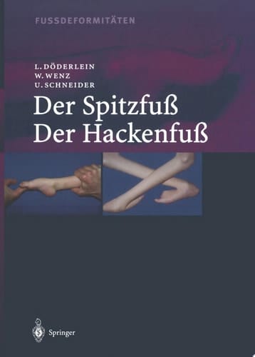 Fussdeformitäten