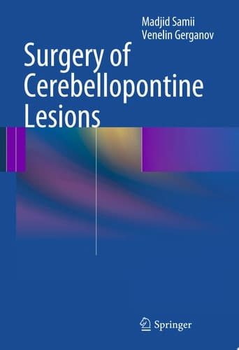 Surgery of Cerebellopontine Lesions
