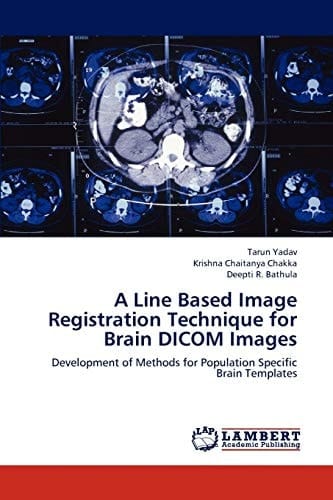 A Line Based Image Registration Technique for Brain Dicom Images