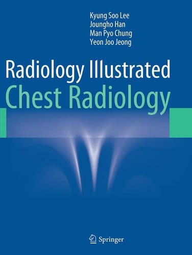 Radiology Illustrated: Chest Radiology
