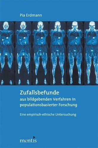 Zufallsbefunde Aus Bildgebenden Verfahren in Populationsbasierter Forschung: Eine Empirisch-Ethische Untersuchung (German Edition)