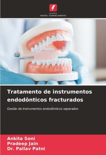 Tratamento de instrumentos endodônticos fracturados: Gestão de instrumentos endodônticos separados (Portuguese Edition)