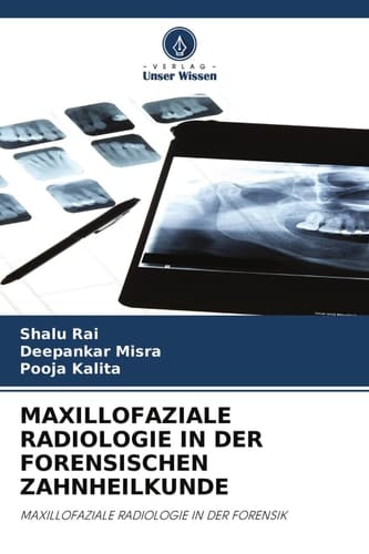 MAXILLOFAZIALE RADIOLOGIE IN DER FORENSISCHEN ZAHNHEILKUNDE: MAXILLOFAZIALE RADIOLOGIE IN DER FORENSIK (German Edition)