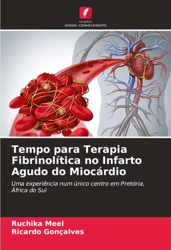 Tempo para Terapia Fibrinolítica no Infarto Agudo do Miocárdio (Portuguese Edition)