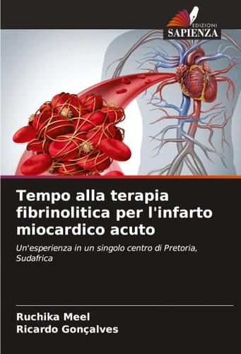 Tempo alla terapia fibrinolitica per l'infarto miocardico acuto (Italian Edition)