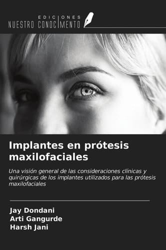 Implantes en prótesis maxilofaciales