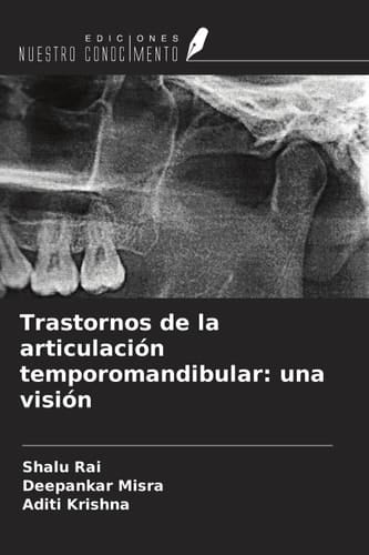 Trastornos de la articulación temporomandibular: una visión (Spanish Edition)