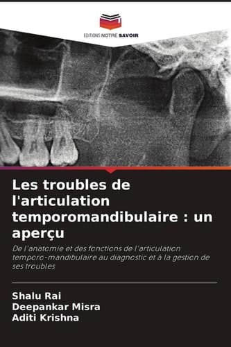 Les troubles de l'articulation temporomandibulaire : un aperçu: De l'anatomie et des fonctions de l'articulation temporo-mandibulaire au diagnostic et à la gestion de ses troubles (French Edition)