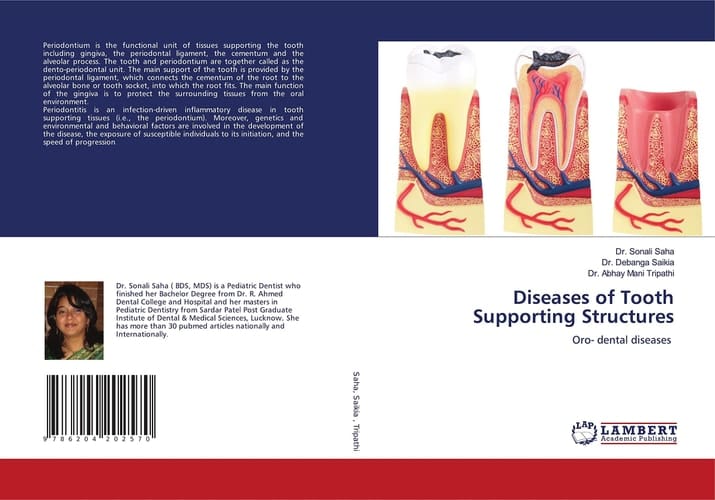 Diseases of Tooth Supporting Structures: Oro- dental diseases