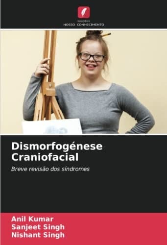 Dismorfogénese Craniofacial: Breve revisão dos síndromes (Portuguese Edition)