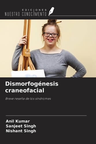 Dismorfogénesis craneofacial: Breve reseña de los síndromes (Spanish Edition)