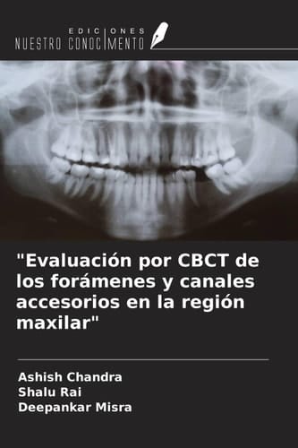 "Evaluación por CBCT de los forámenes y canales accesorios en la región maxilar" (Spanish Edition)