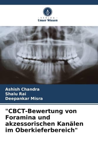 "CBCT-Bewertung von Foramina und akzessorischen Kanälen im Oberkieferbereich" (German Edition)