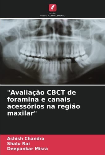 "Avaliação CBCT de foramina e canais acessórios na região maxilar" (Portuguese Edition)