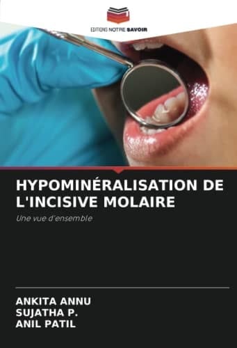 HYPOMINÉRALISATION DE L'INCISIVE MOLAIRE: Une vue d'ensemble (French Edition)
