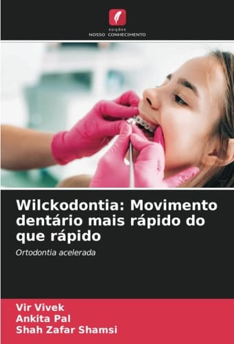 Wilckodontia: Movimento dentário mais rápido do que rápido: Ortodontia acelerada (Portuguese Edition)