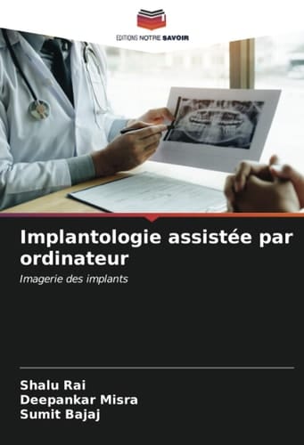 Implantologie assistée par ordinateur: Imagerie des implants (French Edition)