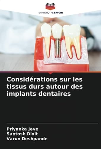 Considérations sur les tissus durs autour des implants dentaires (French Edition)