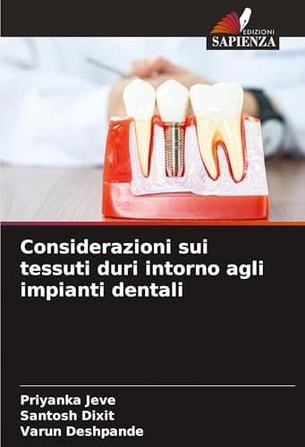 Considerazioni sui tessuti duri intorno agli impianti dentali (Italian Edition)