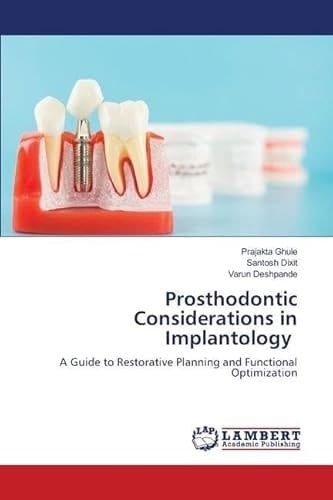 Prosthodontic Considerations in Implantology