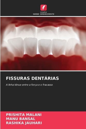 Fissuras Dentárias