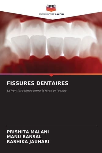 Fissures Dentaires