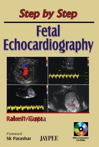 Fetal Echocardiography with 2 Inst