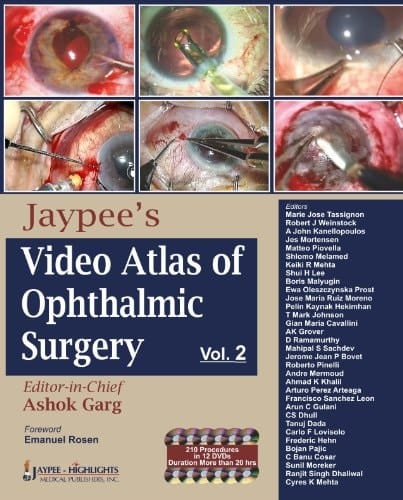 Jaypee's Video Atlas of Ophthalmic Surgery Vol. 2
