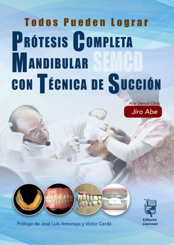 Todos pueden lograr prótesis mandibular completa con técnica de succión (SEMCD)