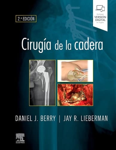 Cirugía de la cadera, 2.ª Edición
