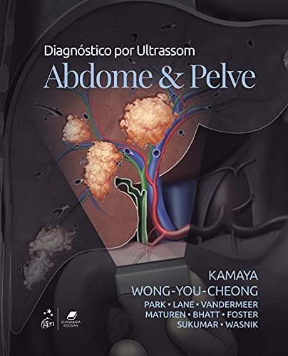 Diagnostico por Ultrassom: Abdome e Pelve