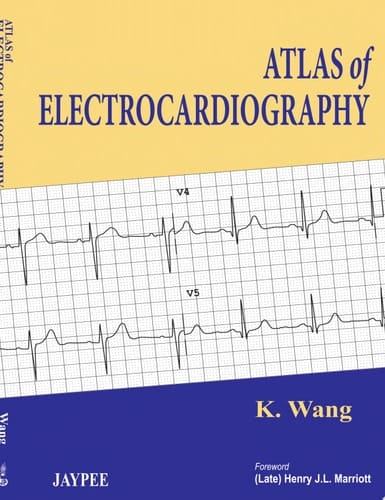 Atlas of Electrocardiography