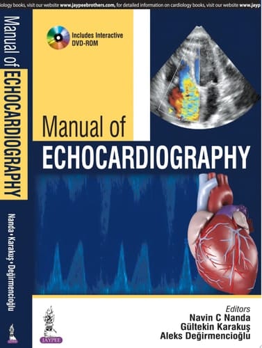 Manual of Echocardiography