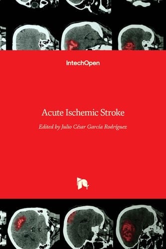 Acute Ischemic Stroke