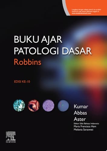 Buku Ajar Patologi Robbins - E-book Buku Ajar Patologi Robbins - E-book