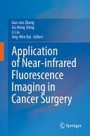 Application of Near-infrared Fluorescence Imaging in Cancer Surgery
