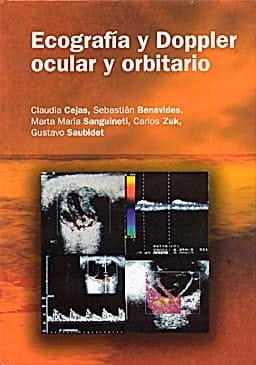 Ecografia y Doppler Ocular y Orbitario