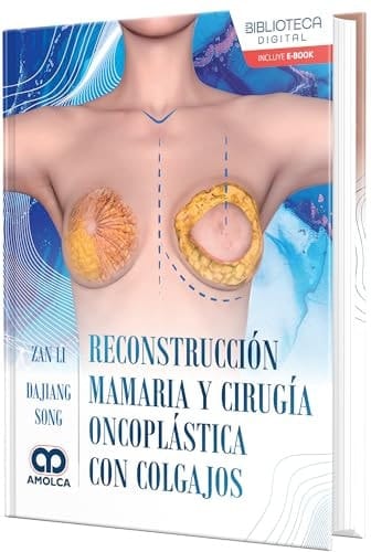 Reconstrucción mamaria y cirugía oncoplástica con colgajos