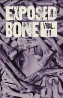 Exposed Bone Volume II