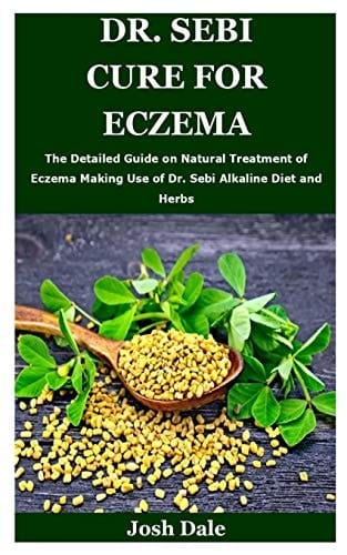 Dr. Sebi Cure for Eczema The Detailed Guide on Natural Treatment of Eczema Making Use of Dr. Sebi Alkaline Diet and Herbs