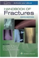 Handbook of Fractures