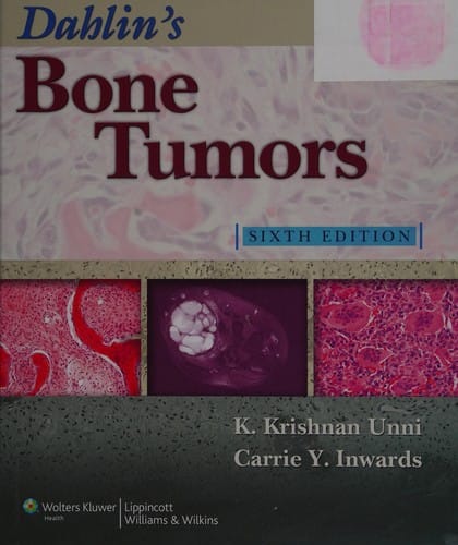 Dahlin's bone tumors