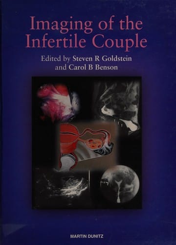 Imaging of the infertile couple