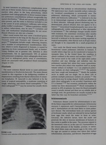 Imaging of diseases of the chest