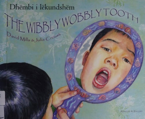 Dhëmbi i lëkundshëm